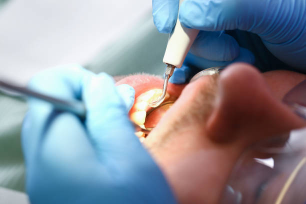 Best Urgent Care for Lost Fillings or Crowns in Swissvale, PA