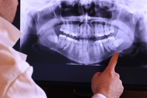 Best Emergency Treatment for Dental Infections or Abscesses in Swissvale, PA
